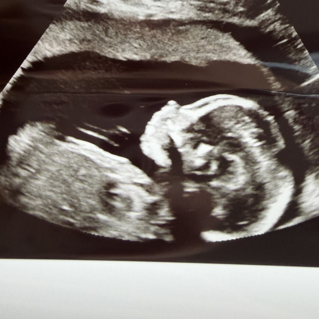 Photo shared by Haley for their Babylist baby registry.
