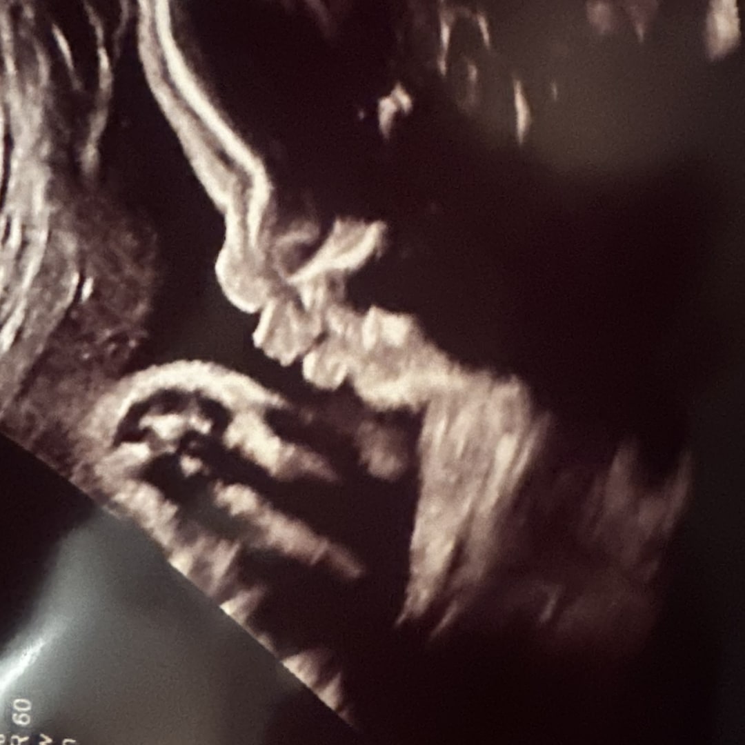 Photo shared by Jazmine for their Babylist baby registry.