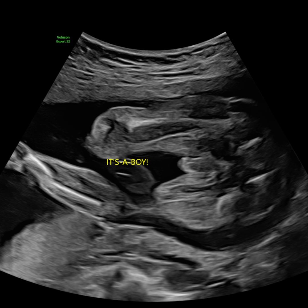 Photo shared by Aaliyha for their Babylist baby registry.