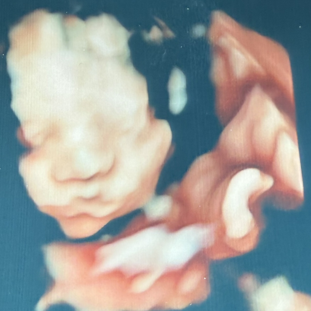 Photo shared by Katie for their Babylist baby registry.