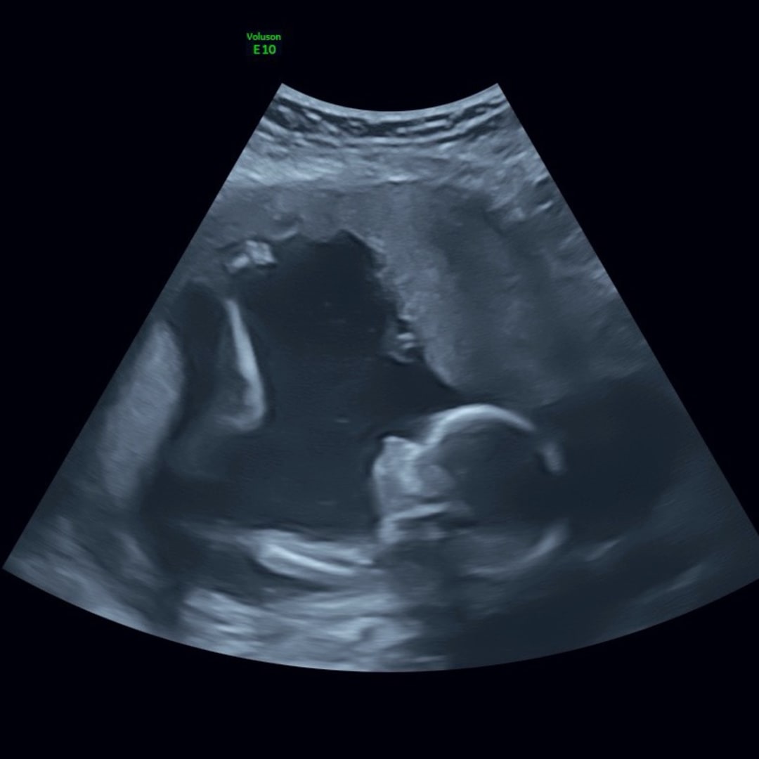 Photo shared by Katie for their Babylist baby registry.