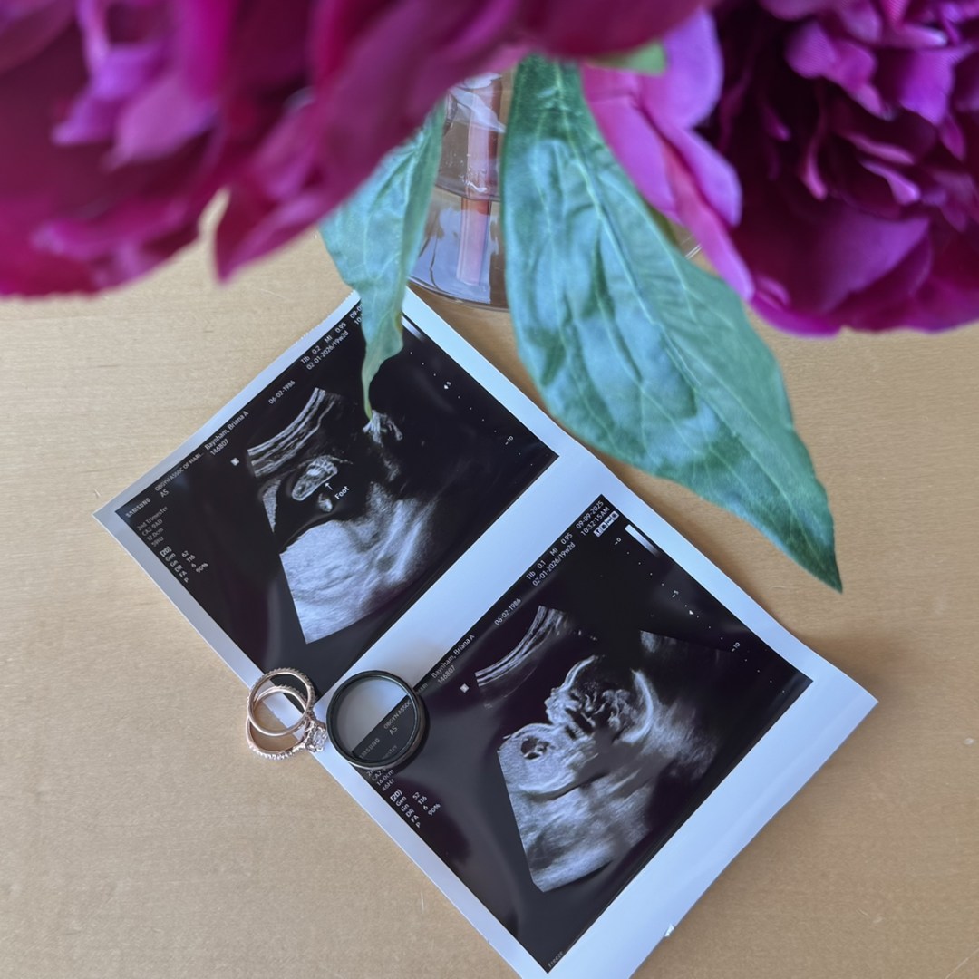 Photo shared by Briana for their Babylist baby registry.