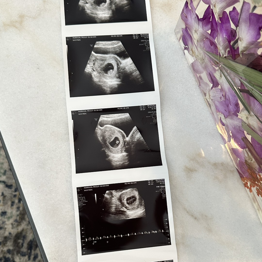 Photo shared by Presley for their Babylist baby registry.