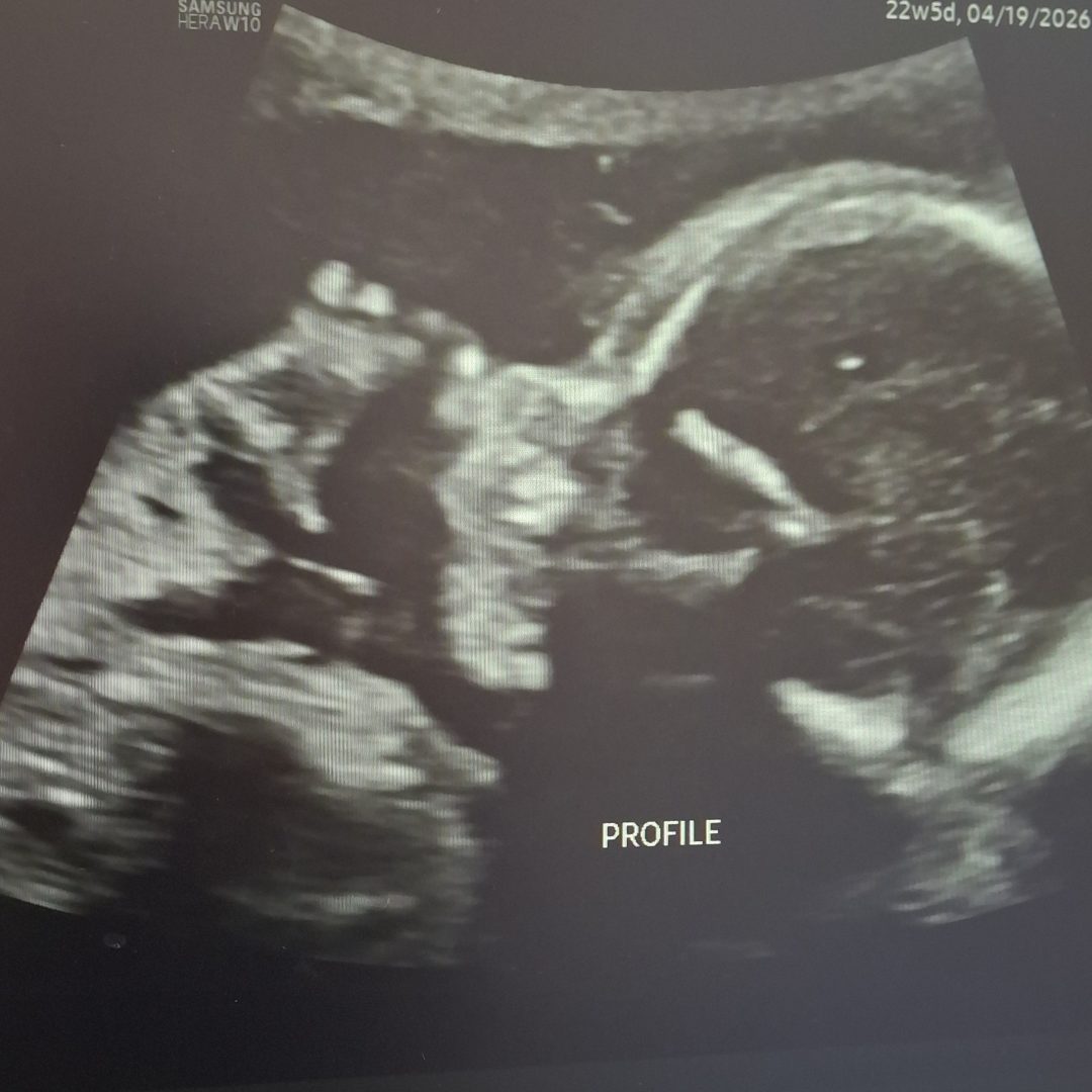 Photo shared by Shawn for their Babylist baby registry.