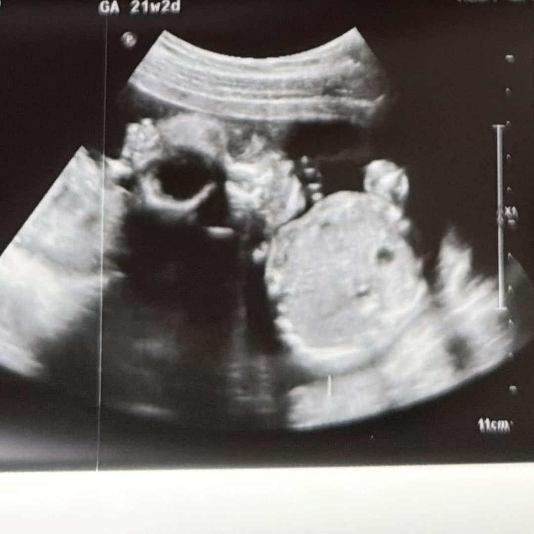 Photo shared by Ranlei for their Babylist baby registry.