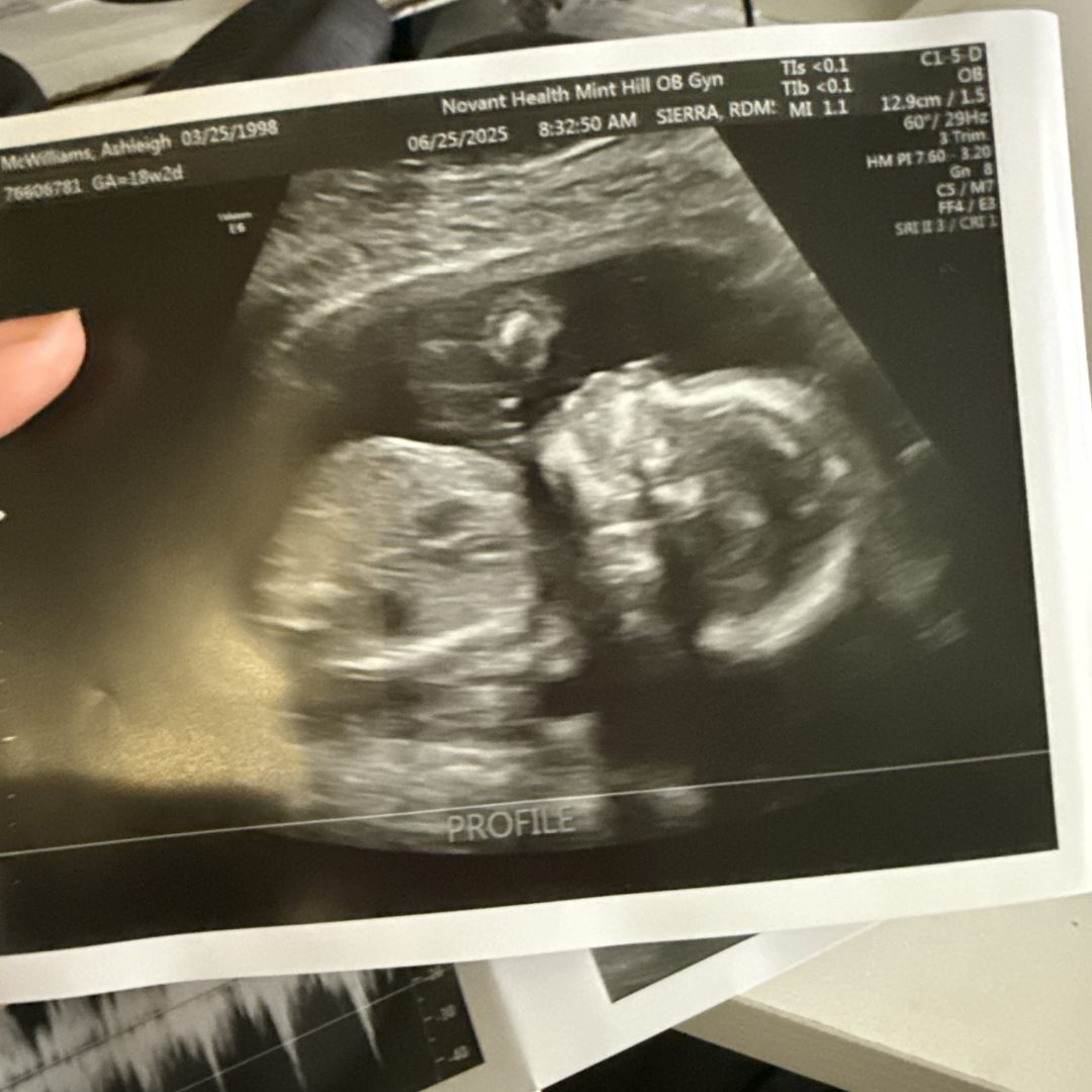 Photo shared by Ashleigh for their Babylist baby registry.