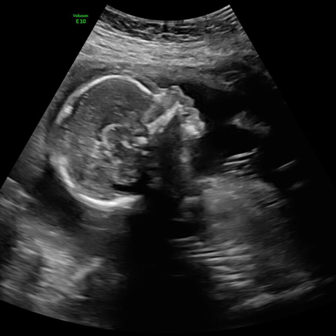 Photo shared by Adi for their Babylist baby registry.
