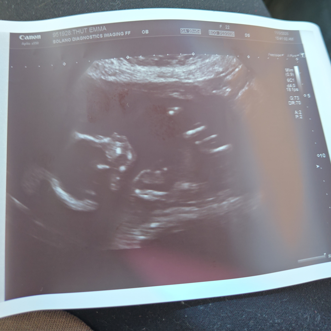 Photo shared by Emma for their Babylist baby registry.