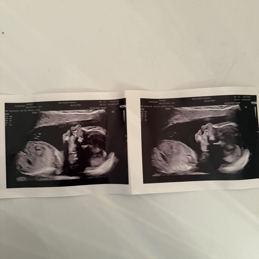 Photo shared by Lisa for their Babylist baby registry.