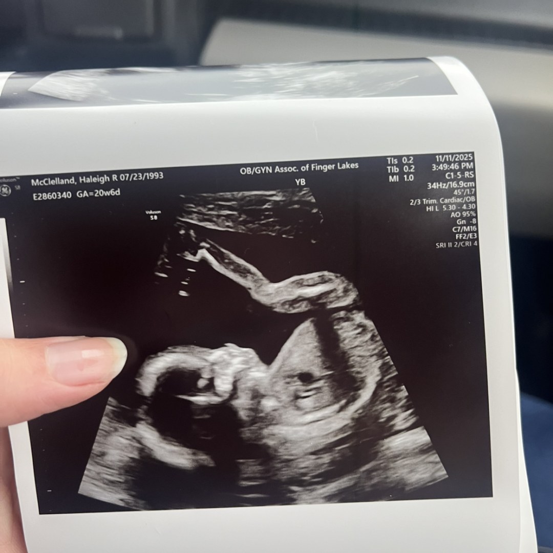 Photo shared by Haleigh for their Babylist baby registry.