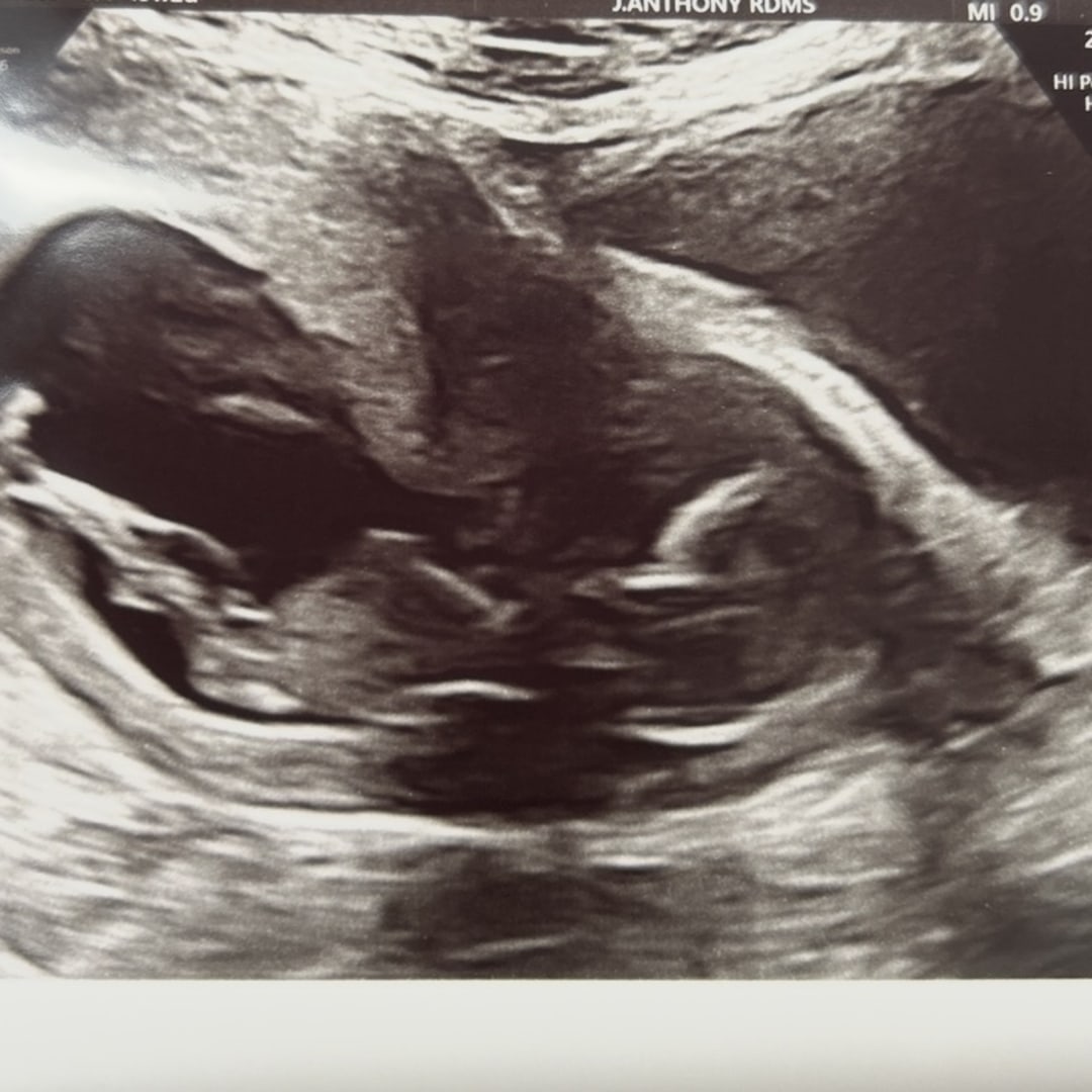 Photo shared by Diondra for their Babylist baby registry.