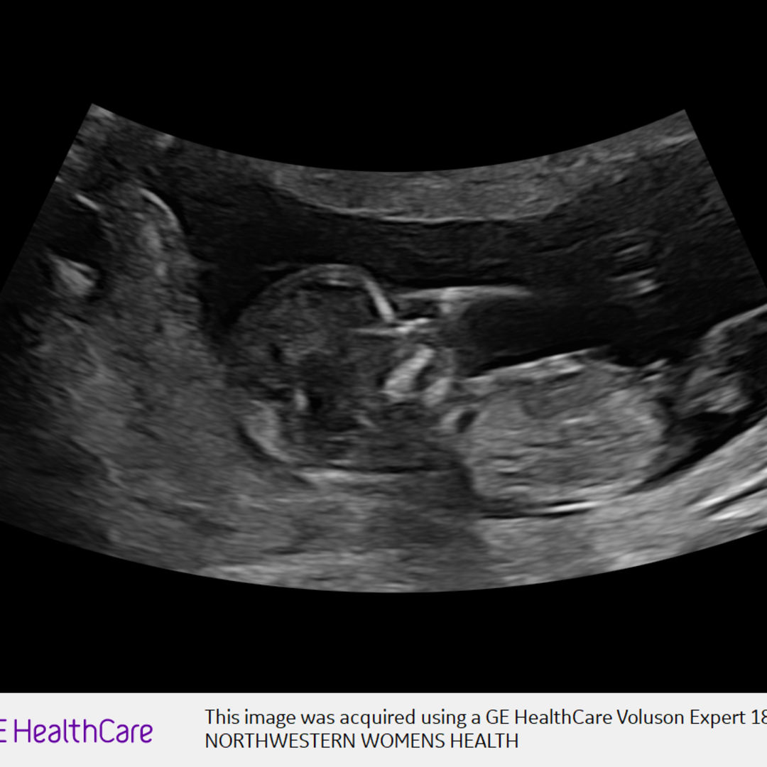 Photo shared by Jamie for their Babylist baby registry.