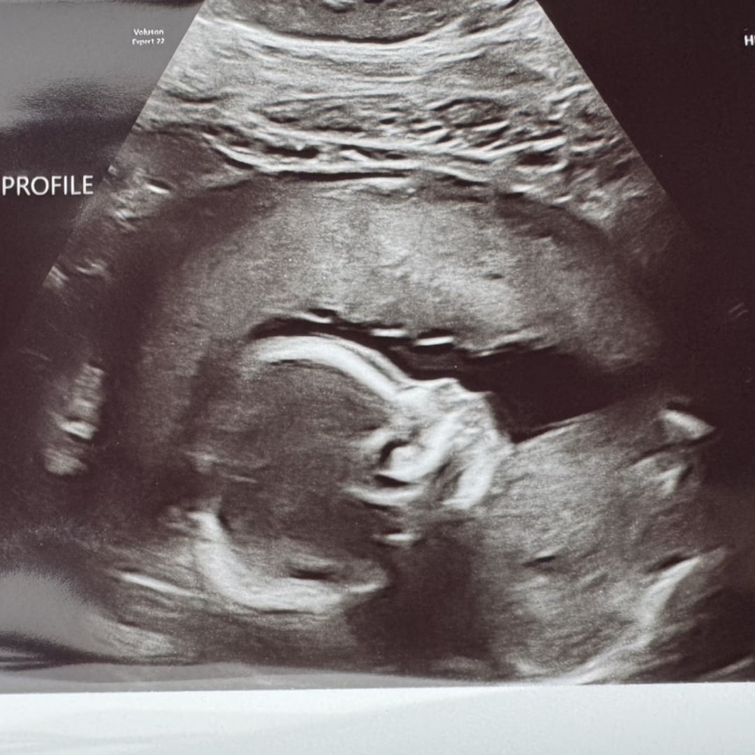 Photo shared by Breanna for their Babylist baby registry.