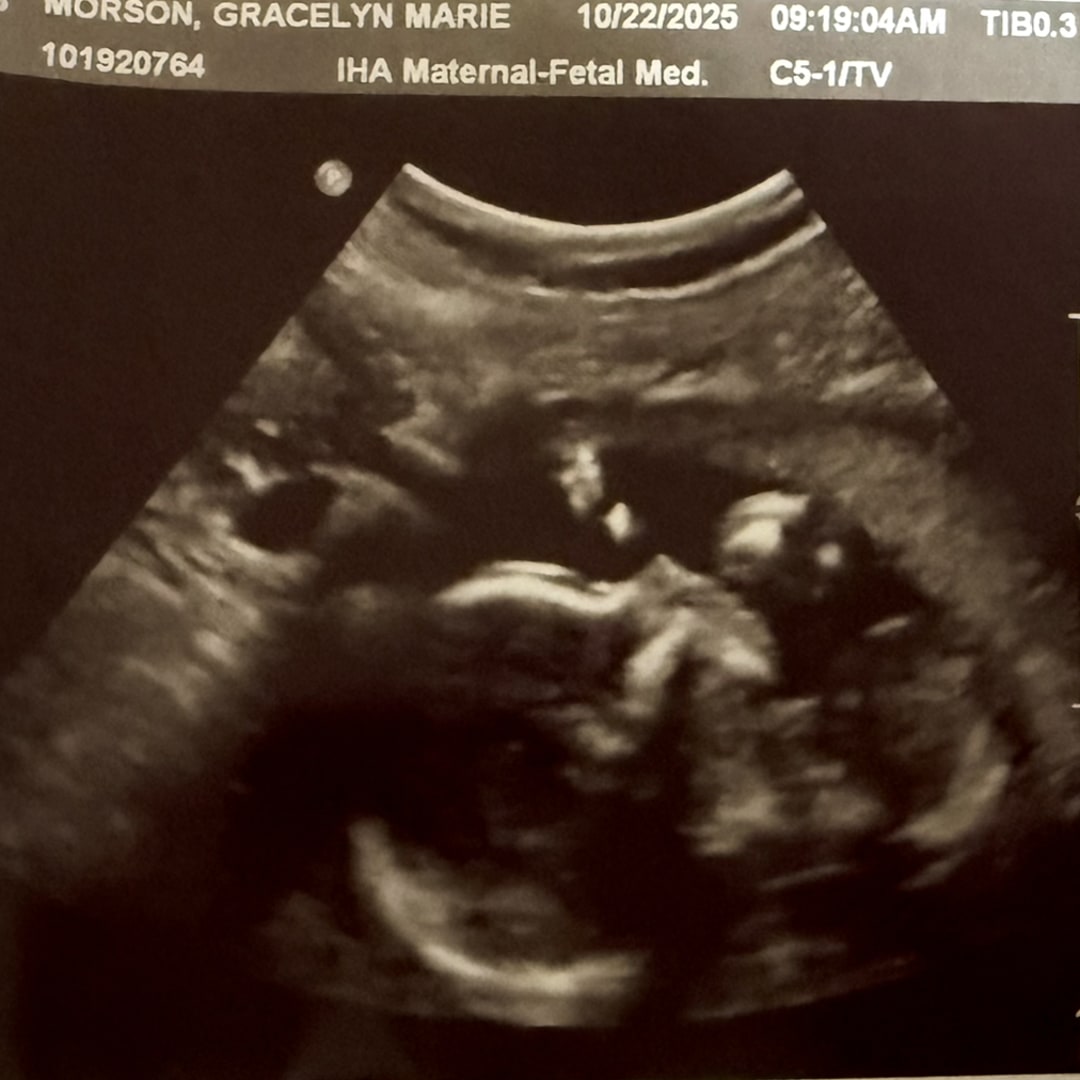 Photo shared by Grace for their Babylist baby registry.