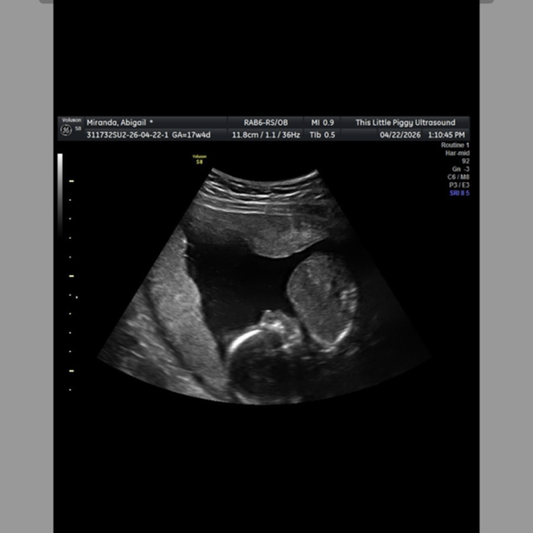 Photo shared by Abigail for their Babylist baby registry.