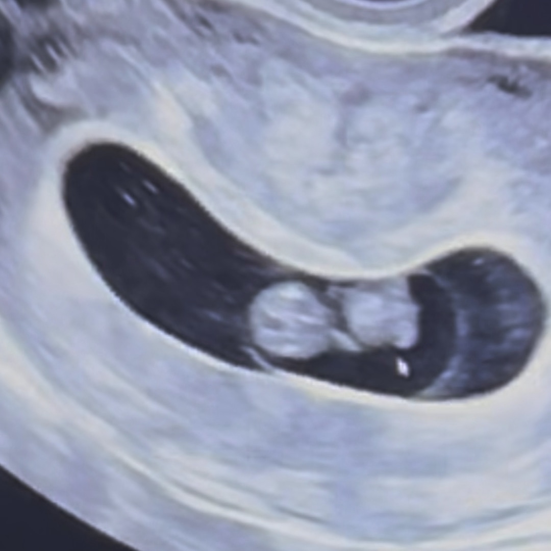 Photo shared by Chloe for their Babylist baby registry.