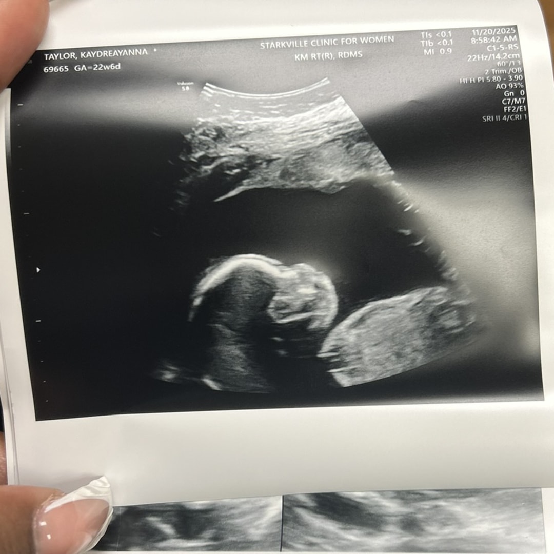 Photo shared by Kay for their Babylist baby registry.