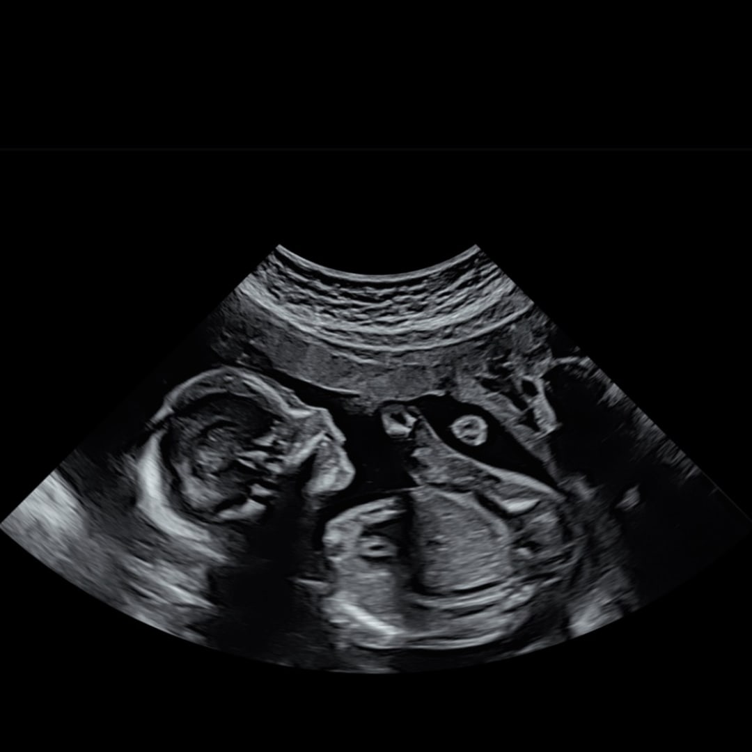Photo shared by Erika for their Babylist baby registry.