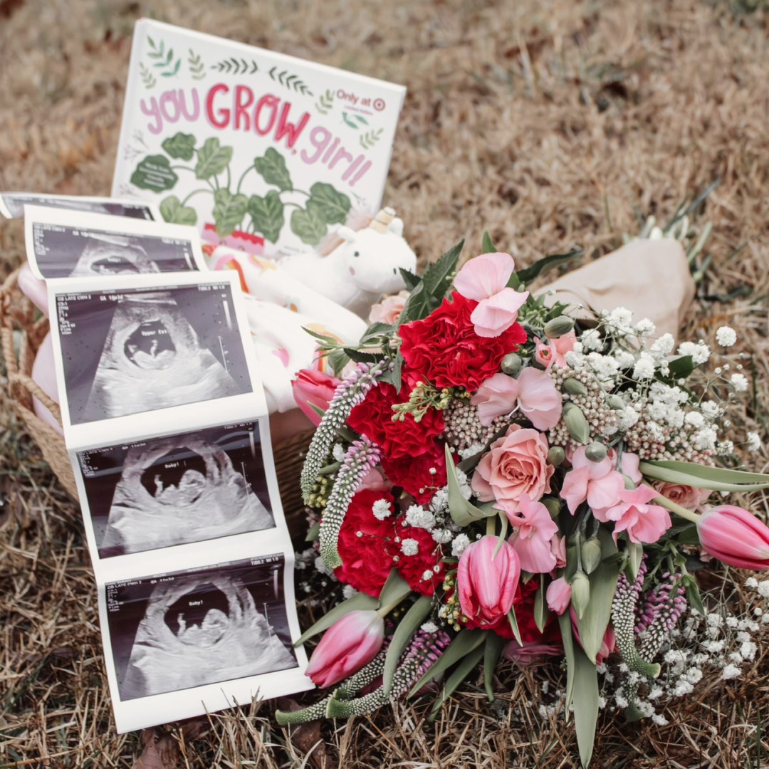 Photo shared by Madison for their Babylist baby registry.