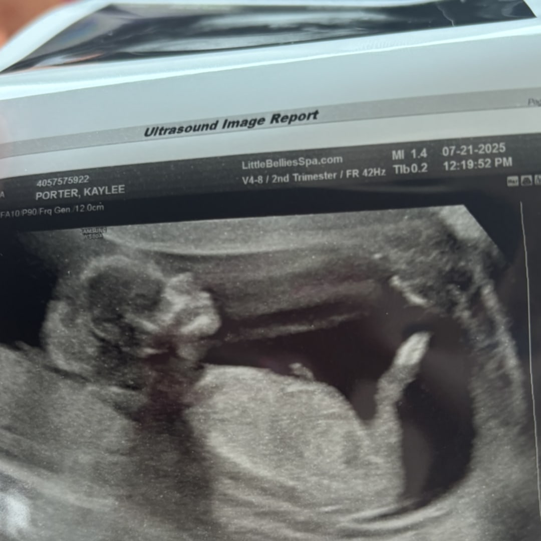 Photo shared by Kaylee for their Babylist baby registry.