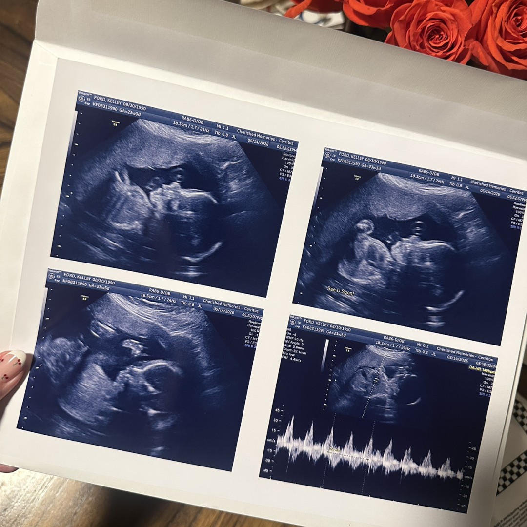 Photo shared by Kelley for their Babylist baby registry.