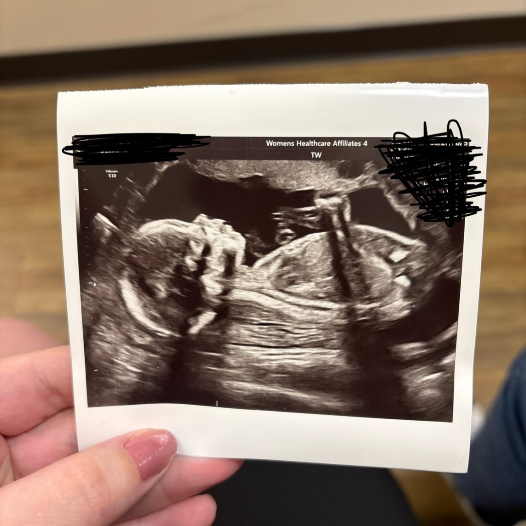 Photo shared by Lex for their Babylist baby registry.