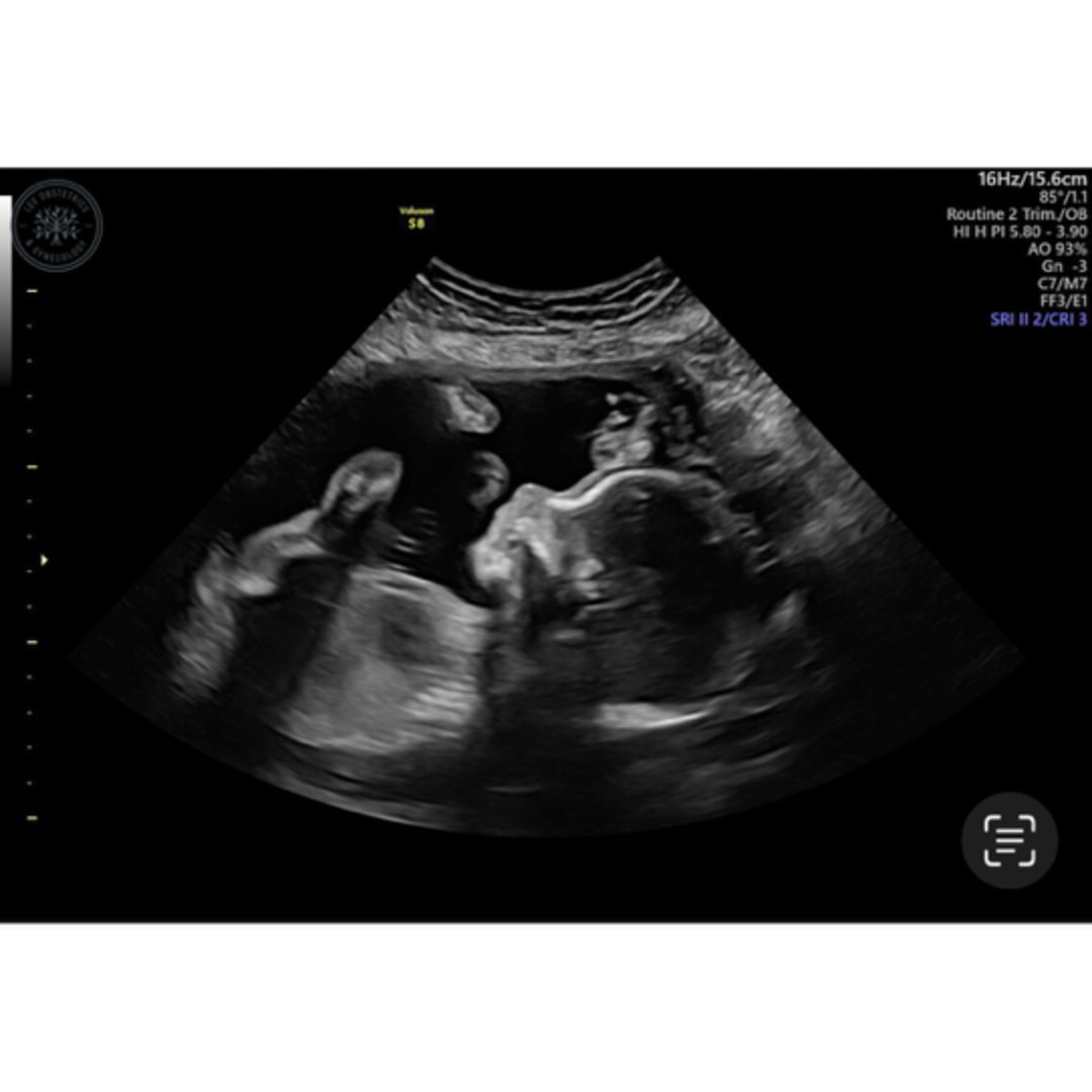 Photo shared by Abby for their Babylist baby registry.