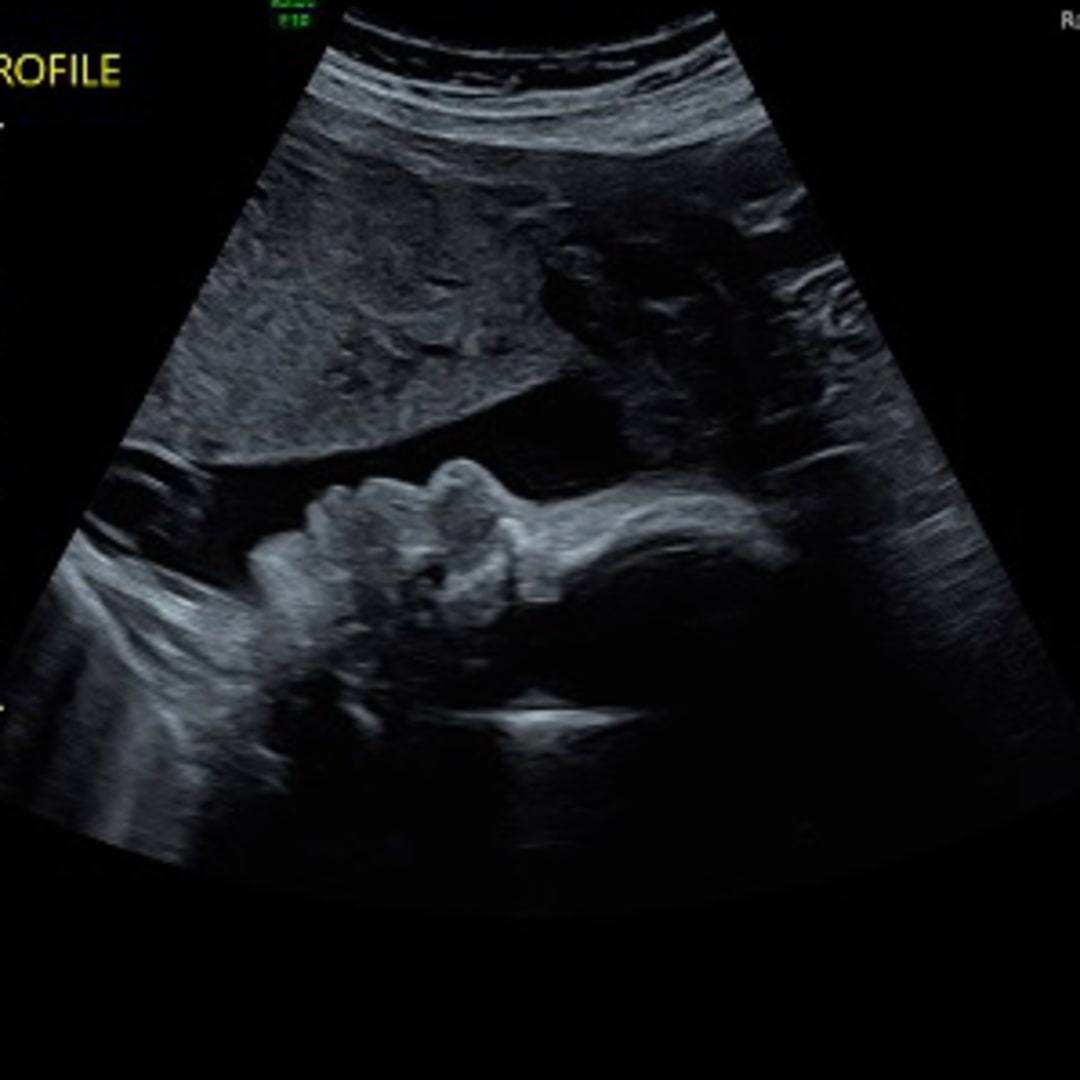 Photo shared by Caitlin for their Babylist baby registry.