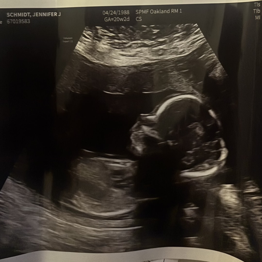 Photo shared by Jennifer for their Babylist baby registry.