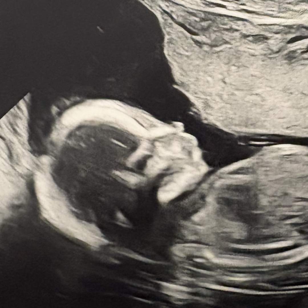 Photo shared by Blakely for their Babylist baby registry.