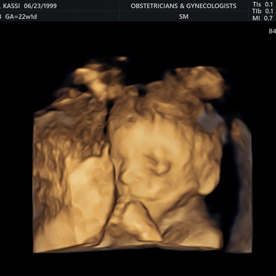 Photo shared by Kassi for their Babylist baby registry.