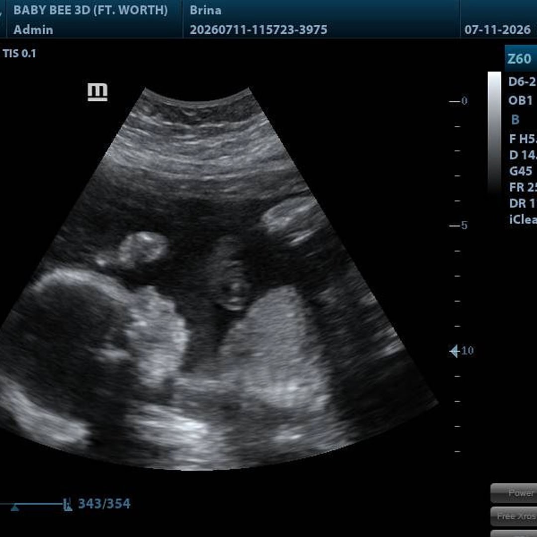 Photo shared by Brina for their Babylist baby registry.