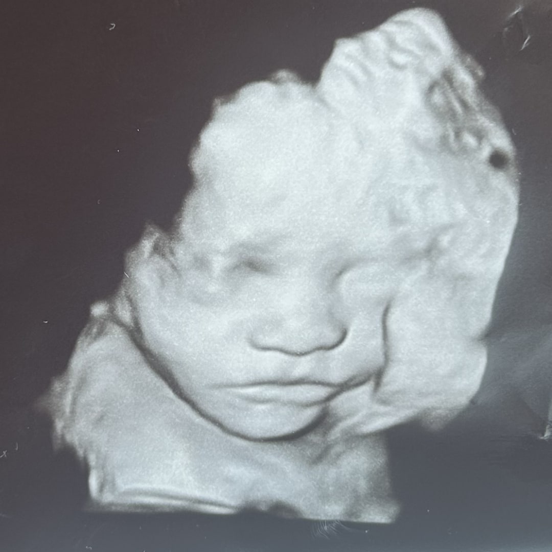 Photo shared by Sydney for their Babylist baby registry.