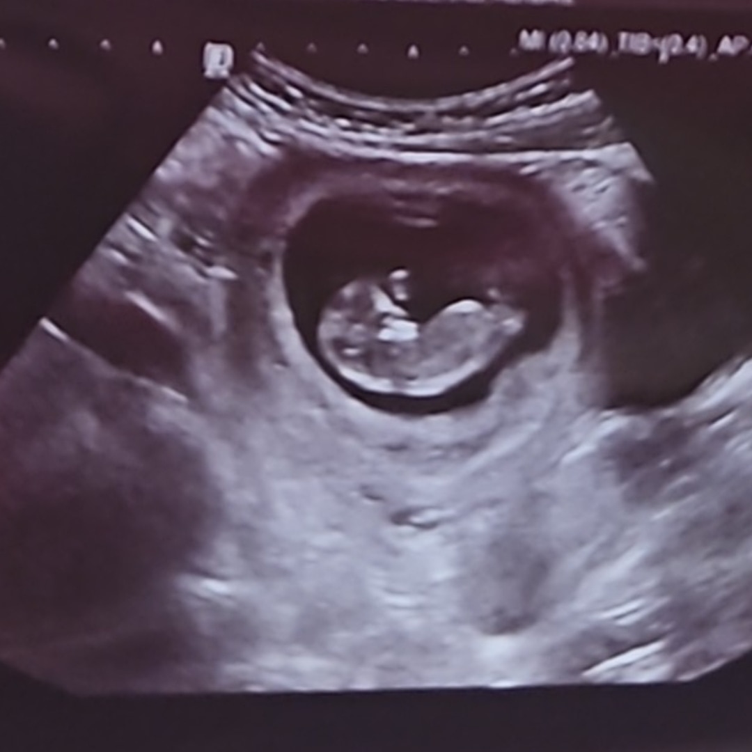 Photo shared by Abigail for their Babylist baby registry.