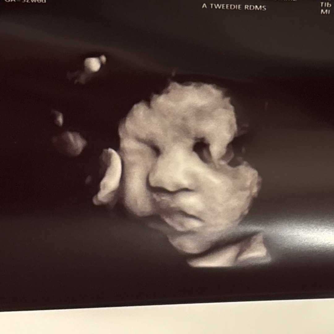 Photo shared by Gabrielle for their Babylist baby registry.