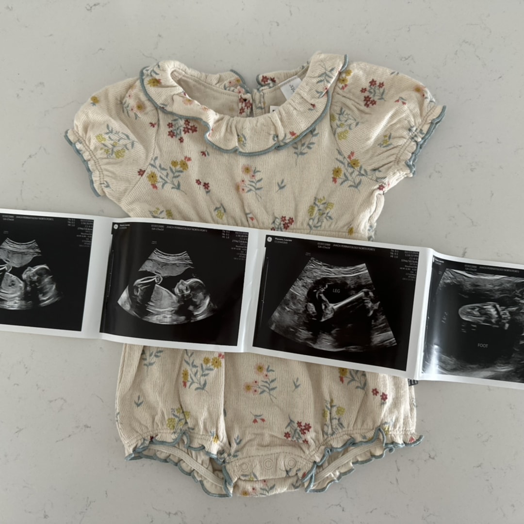 Photo shared by Lauren for their Babylist baby registry.