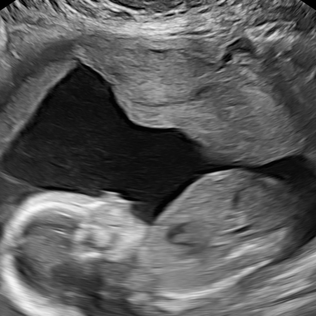 Photo shared by Megan for their Babylist baby registry.