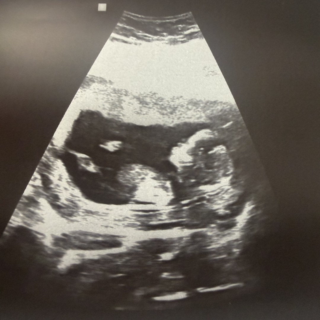 Photo shared by Carissa for their Babylist baby registry.