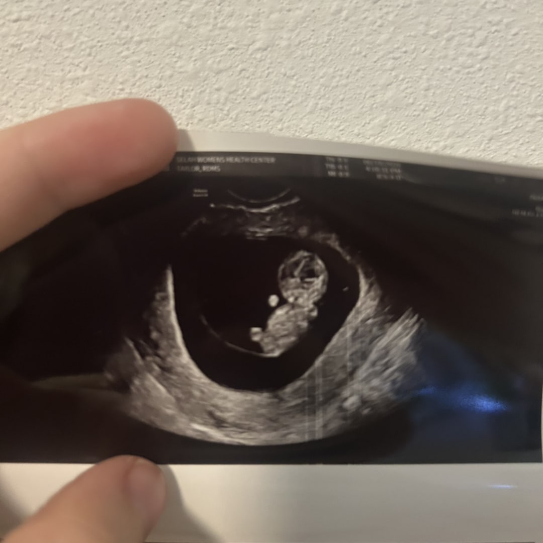 Photo shared by Alora for their Babylist baby registry.