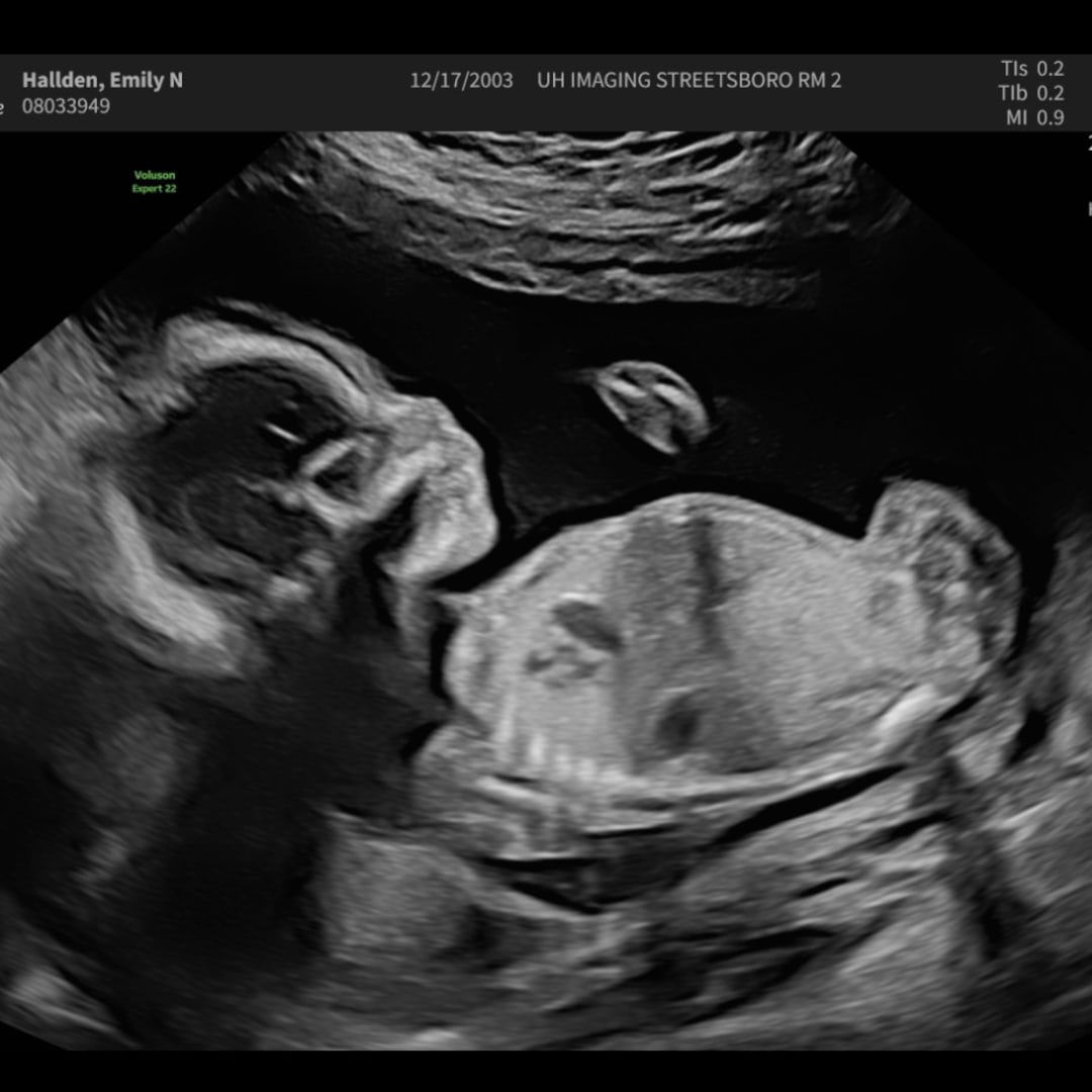 Photo shared by Emily for their Babylist baby registry.