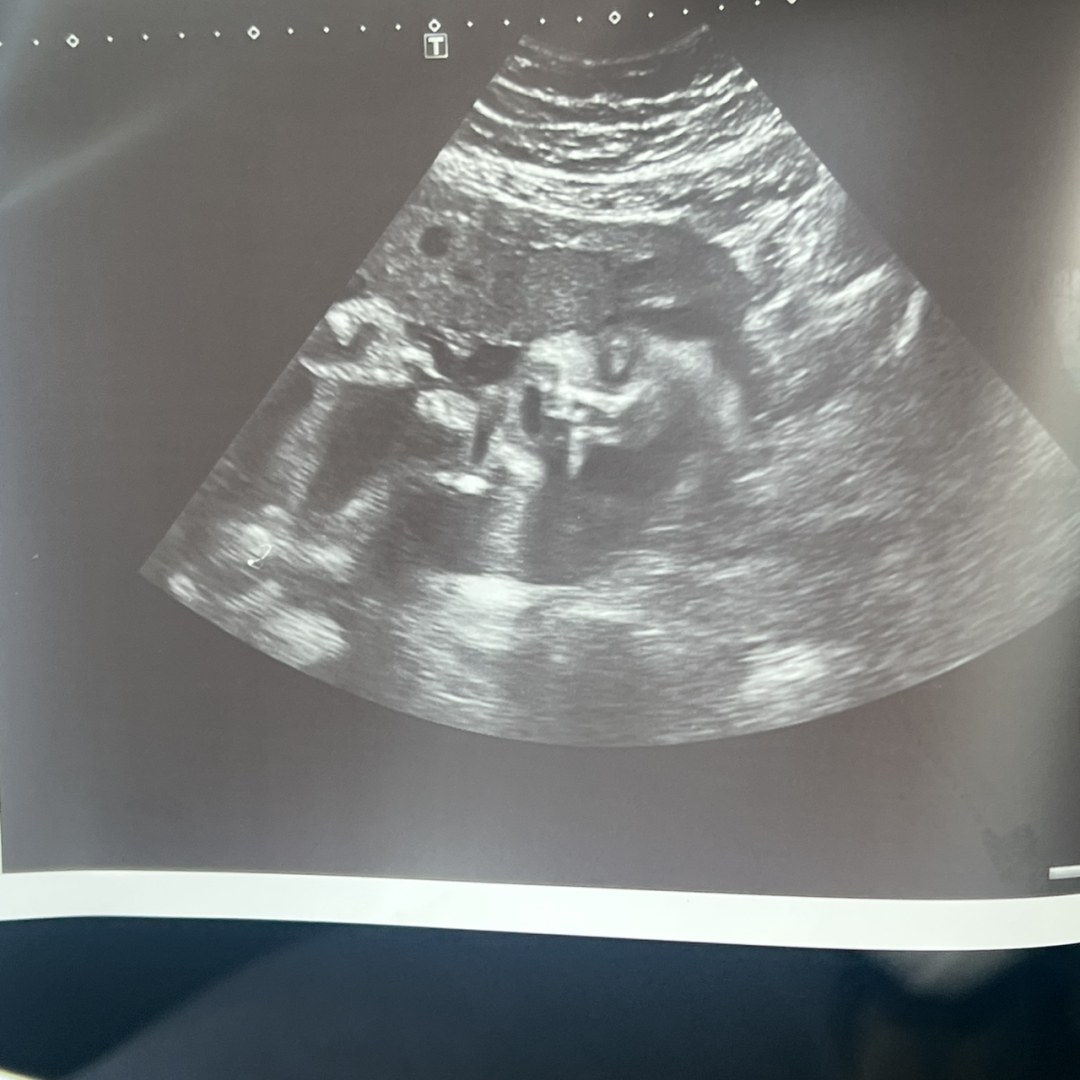 Photo shared by Carolyn for their Babylist baby registry.