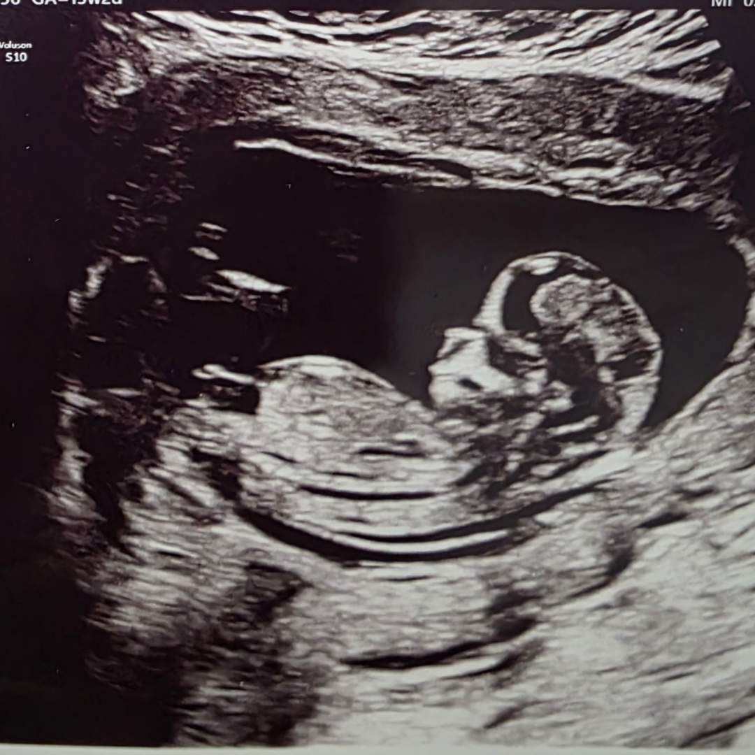 Photo shared by Jaslin for their Babylist baby registry.