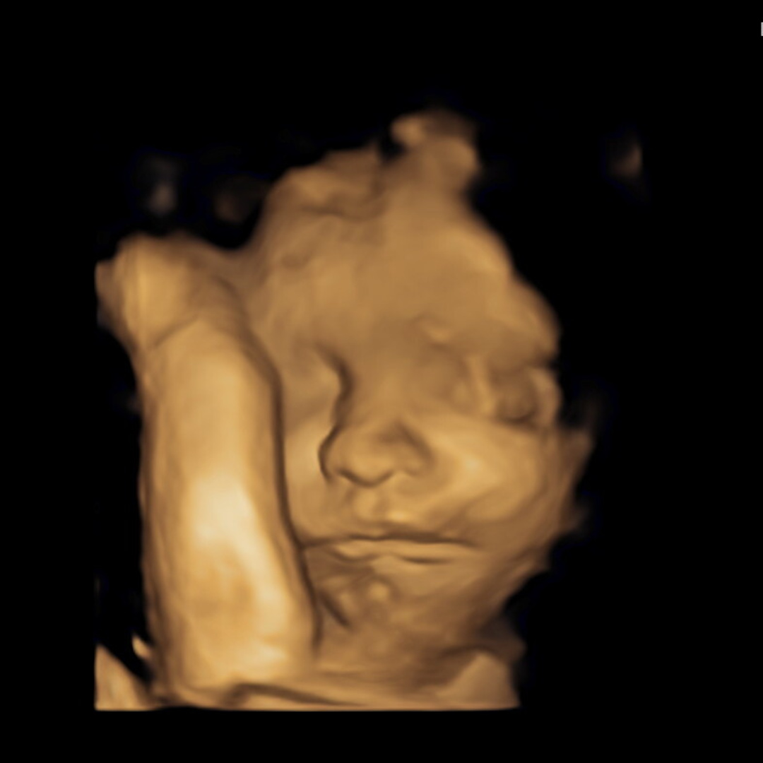Photo shared by Austin & Ludwika for their Babylist baby registry.