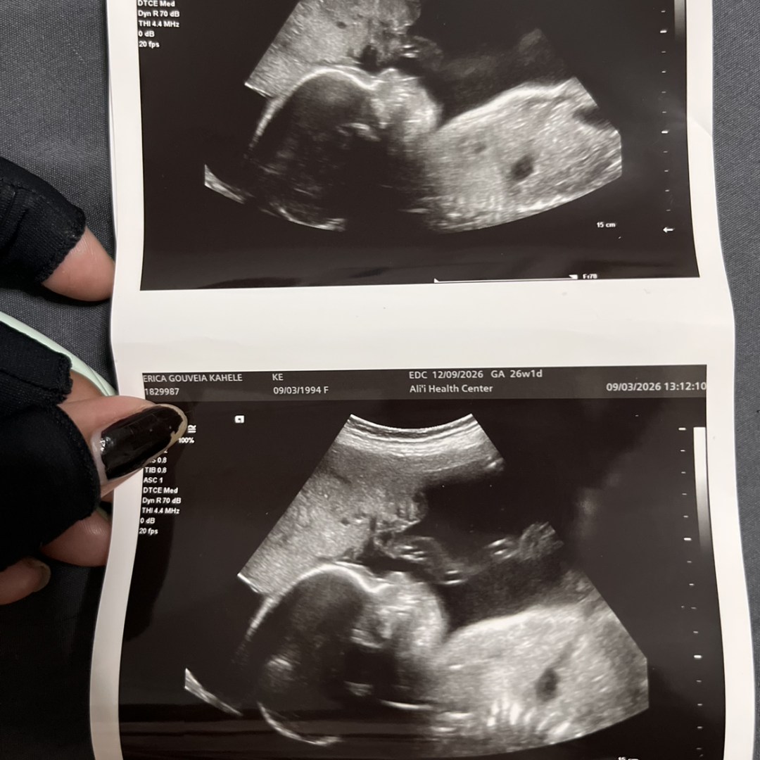 Photo shared by Eri for their Babylist baby registry.