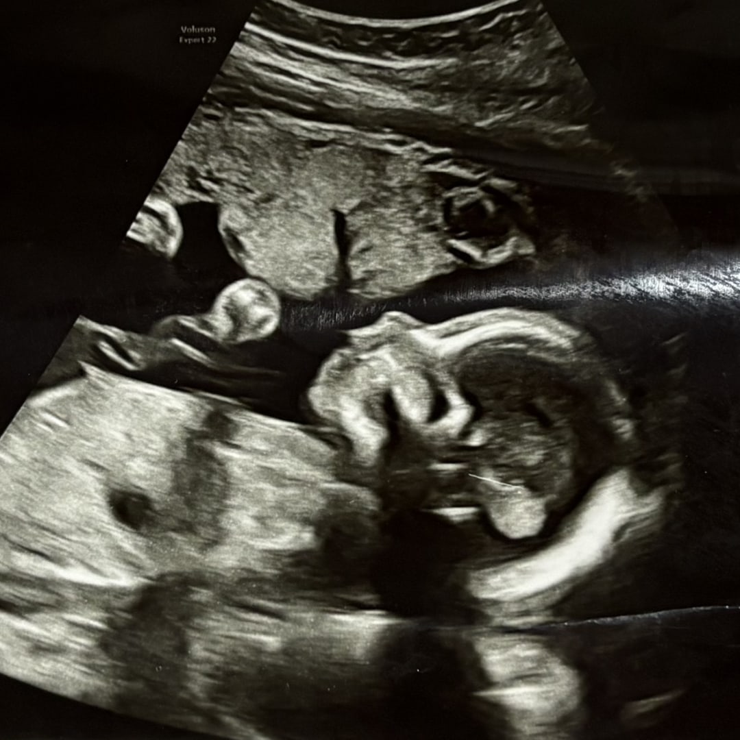 Photo shared by Alina for their Babylist baby registry.