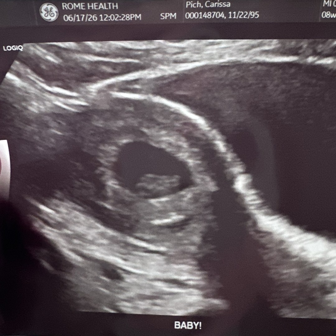 Photo shared by Carissa for their Babylist baby registry.
