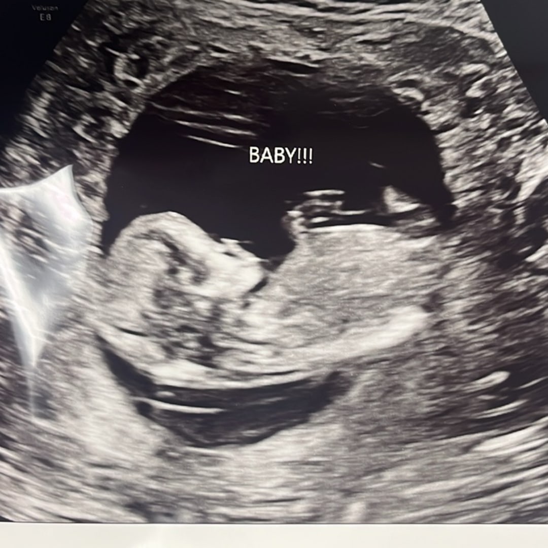 Photo shared by Abby for their Babylist baby registry.