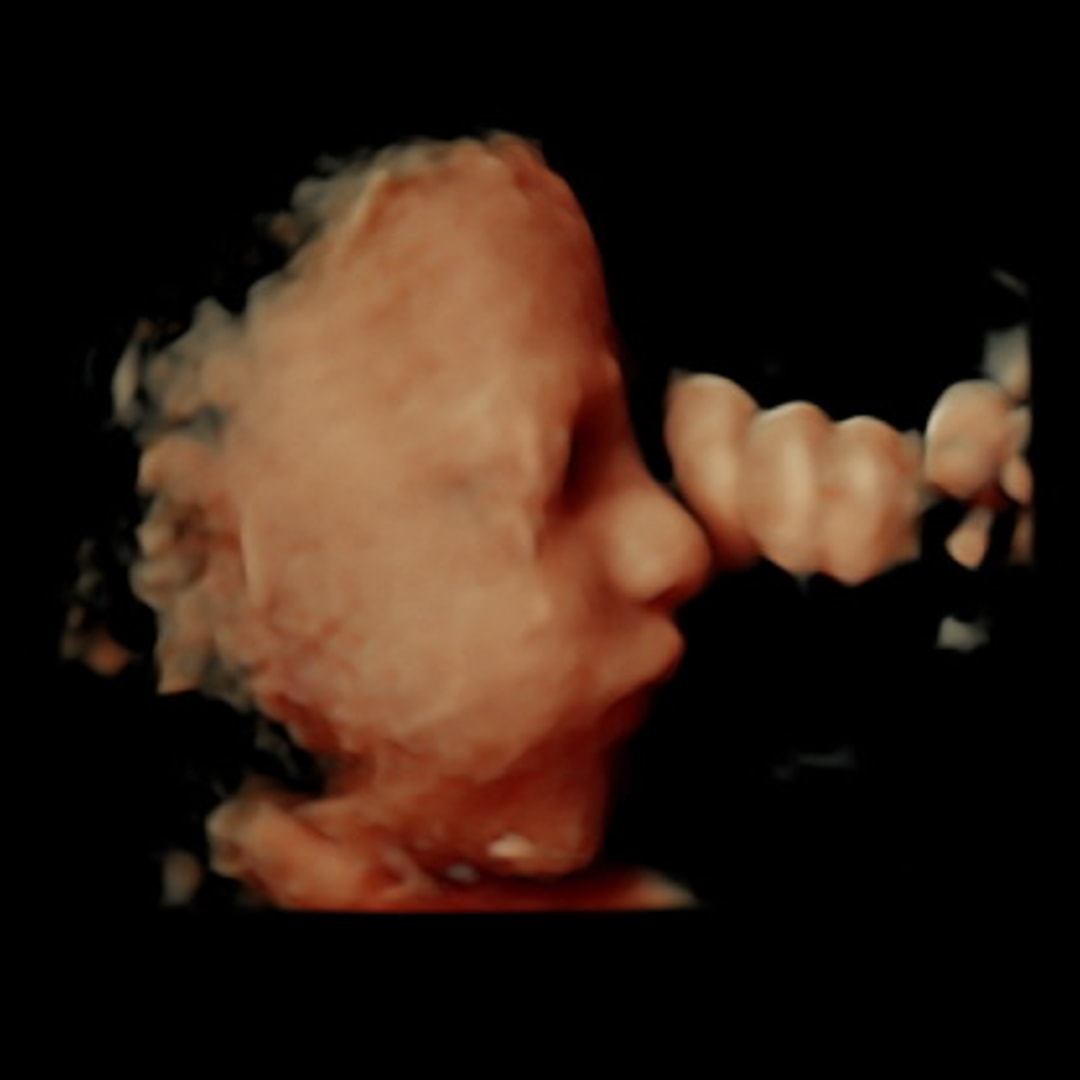 Photo shared by McKenna for their Babylist baby registry.