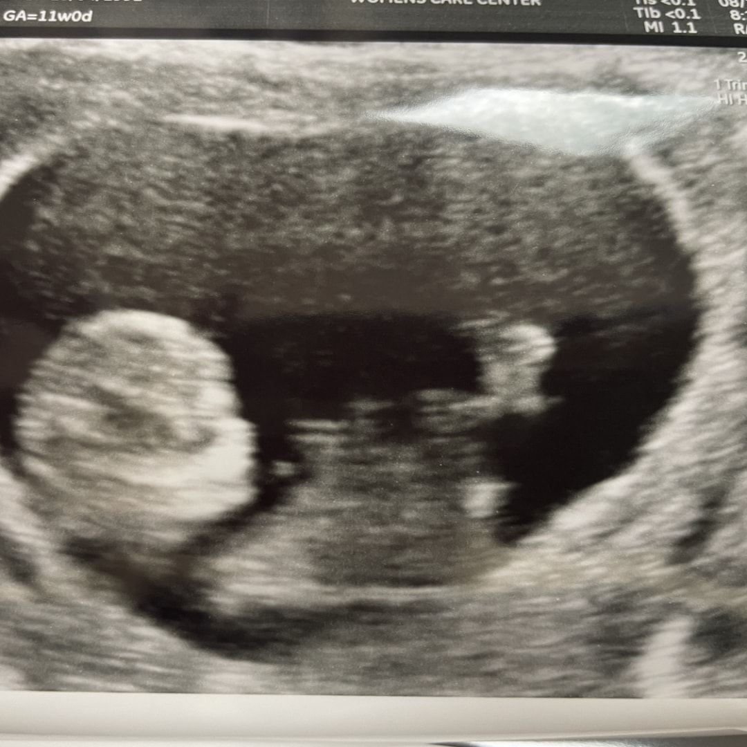 Photo shared by Emily for their Babylist baby registry.