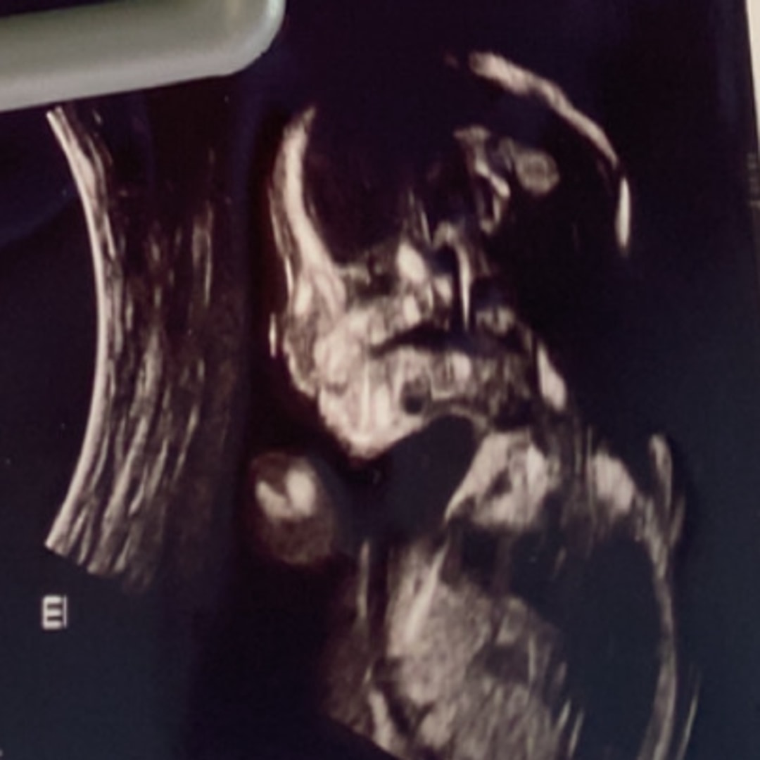 Photo shared by Jessica for their Babylist baby registry.